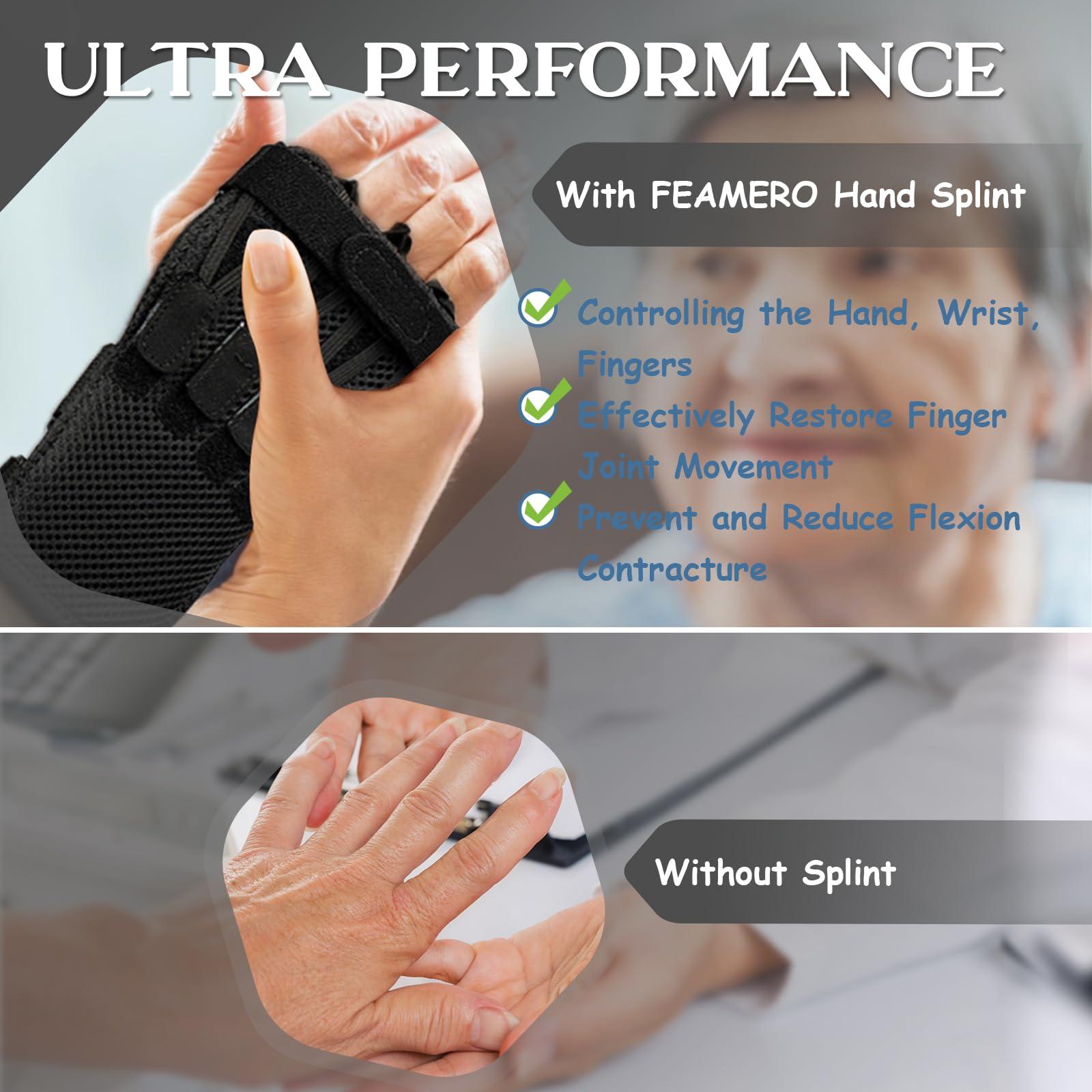 Feamero Feamero Radial Nerve Palsy Splint, Adjustable Finger Extension Brace, Lift Elastic Splint for Drop Wrist, Radial Nerve Injury, Mcp Arthroplasty, Crutch Palsy Treatment, Fit Left & Right Hand