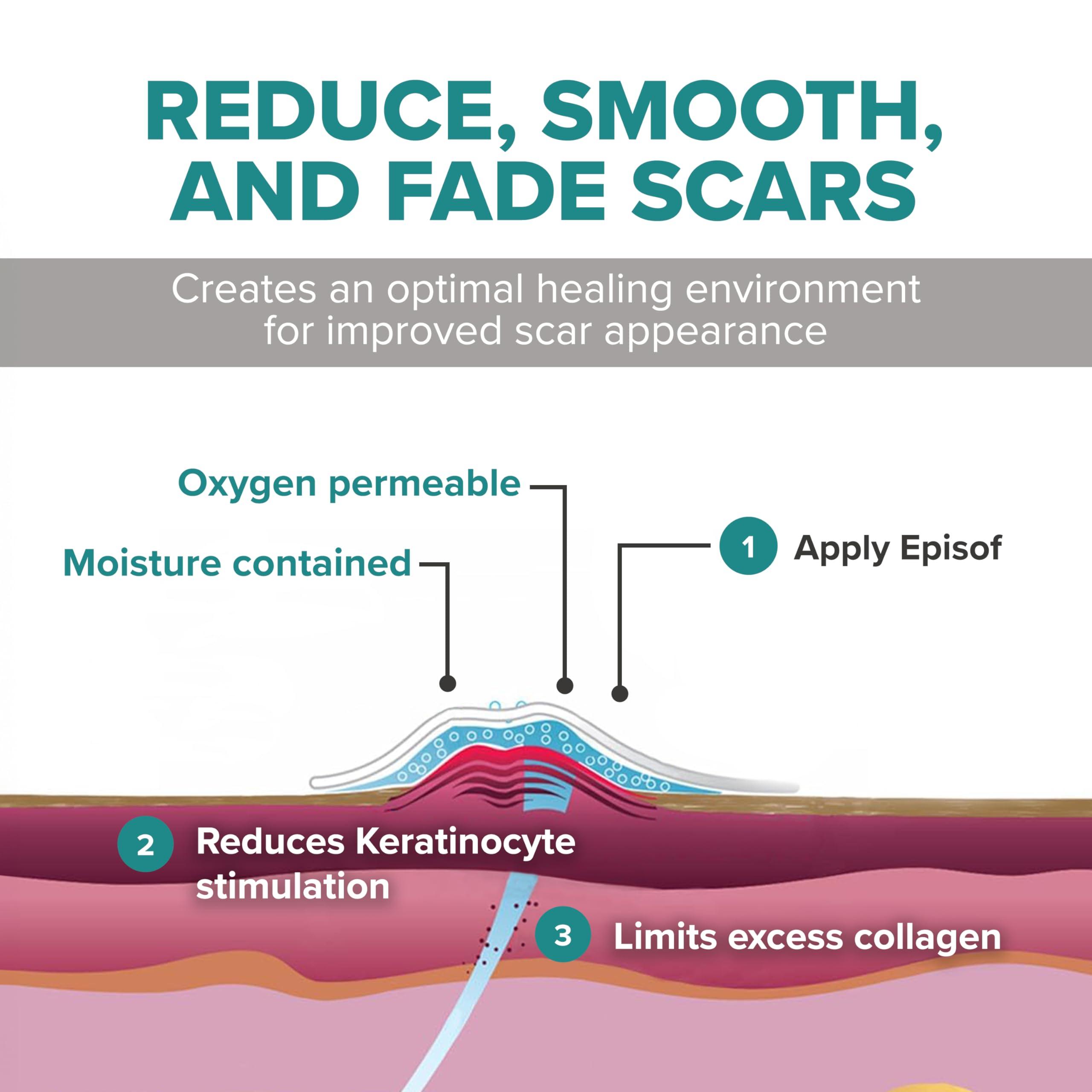 BIODERMIS Biodermis Episof Silicone Scar Gel Pump, Premium Grade Skin Repair Silicone Gel for Scars, Stretch Marks, Fine Lines & Wrinkles - Advanced Scar Care, Fast-Drying, Non-Oily, Scar Cream Post Surgery