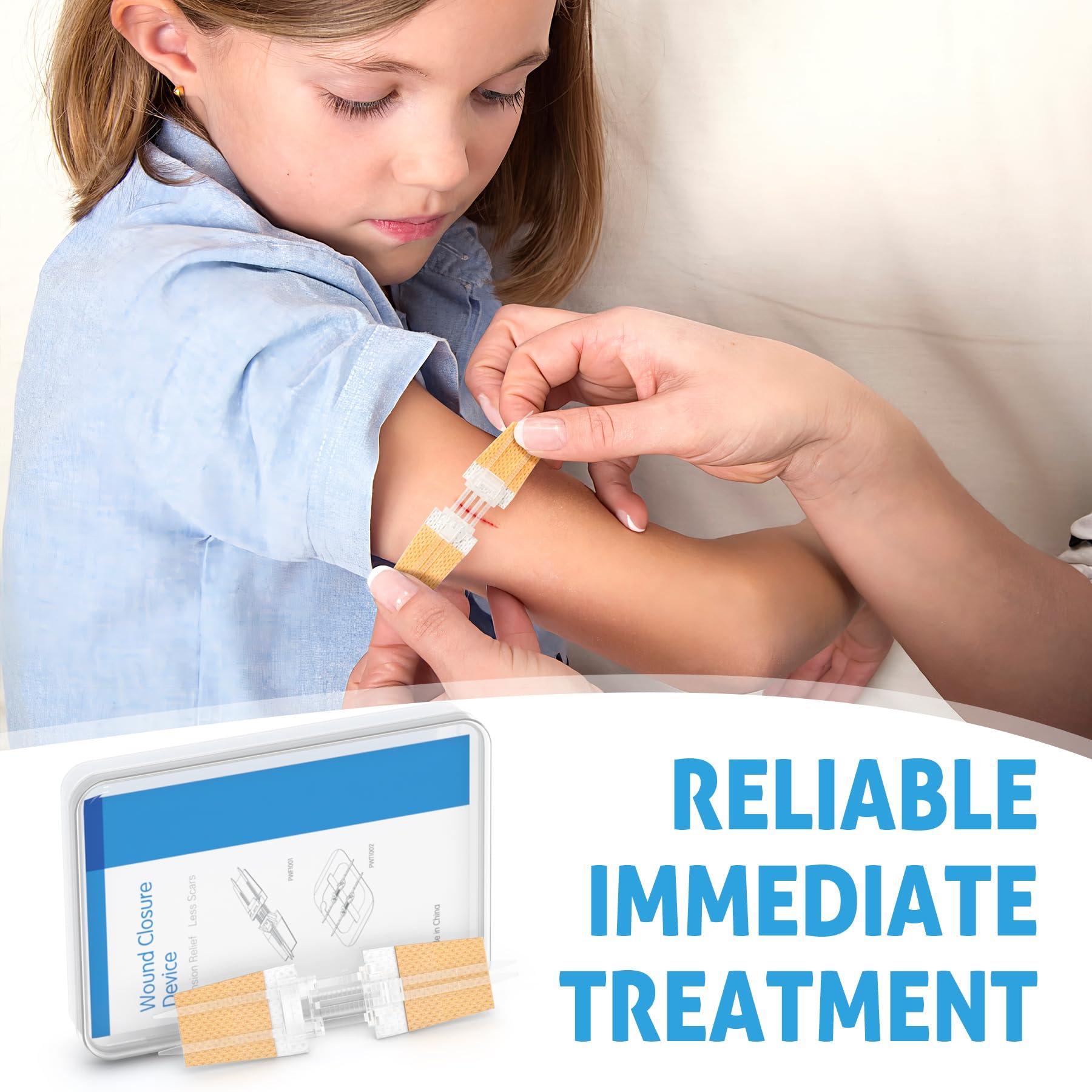 SEABIRD Zip Stitch Wound Closure Kit, Butterfly Bandages,Quick Clot for Easy Use, Surgical Quality,Emergency Laceration Closures Strips, Suture-Free Surgical Repairment, First Aid Wound Care (Yellow, 6)