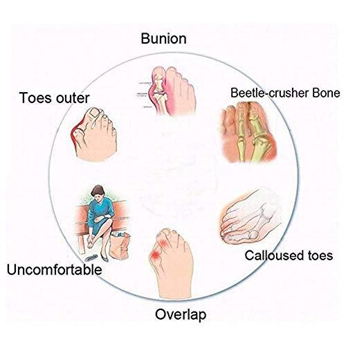 Yusea BestWalk Bunion Sandals Orthopedic Premium Toe Corrector Sandals (Khaki,40)