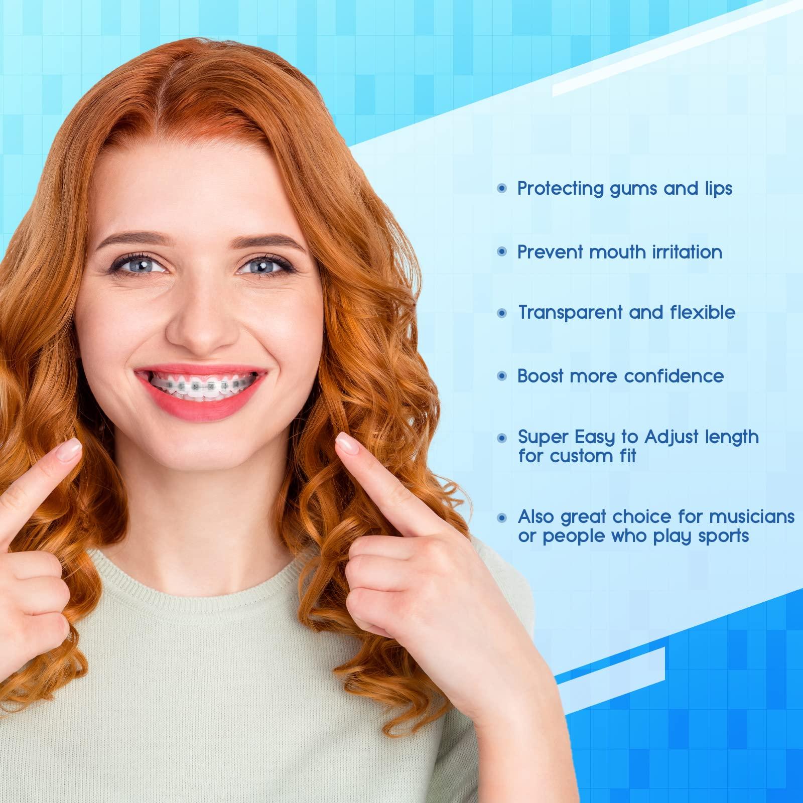 OBrush Obrush Comfort Covers for Braces - Orthodontic Mouth Guard, Lip Protector, Wax Alternative, Lip Shield for Brackets