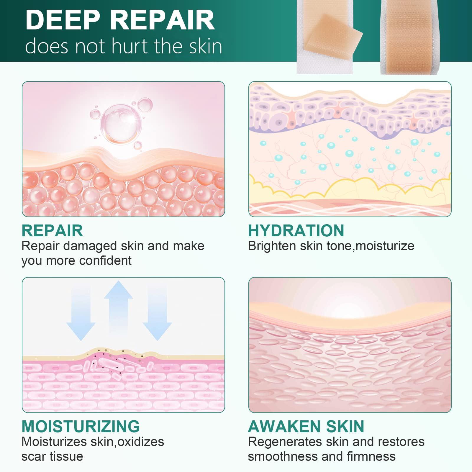AirroYE Silicone Scar Sheets,Silicone Scar Tape(1.6\"x 60\" Roll-1.5M), Reusable And Effective Scar Removal Sheets, Silicone Scar Removal Sheets For Surgical Scars,Healing Keloid, C-Section, Tummy Tuck