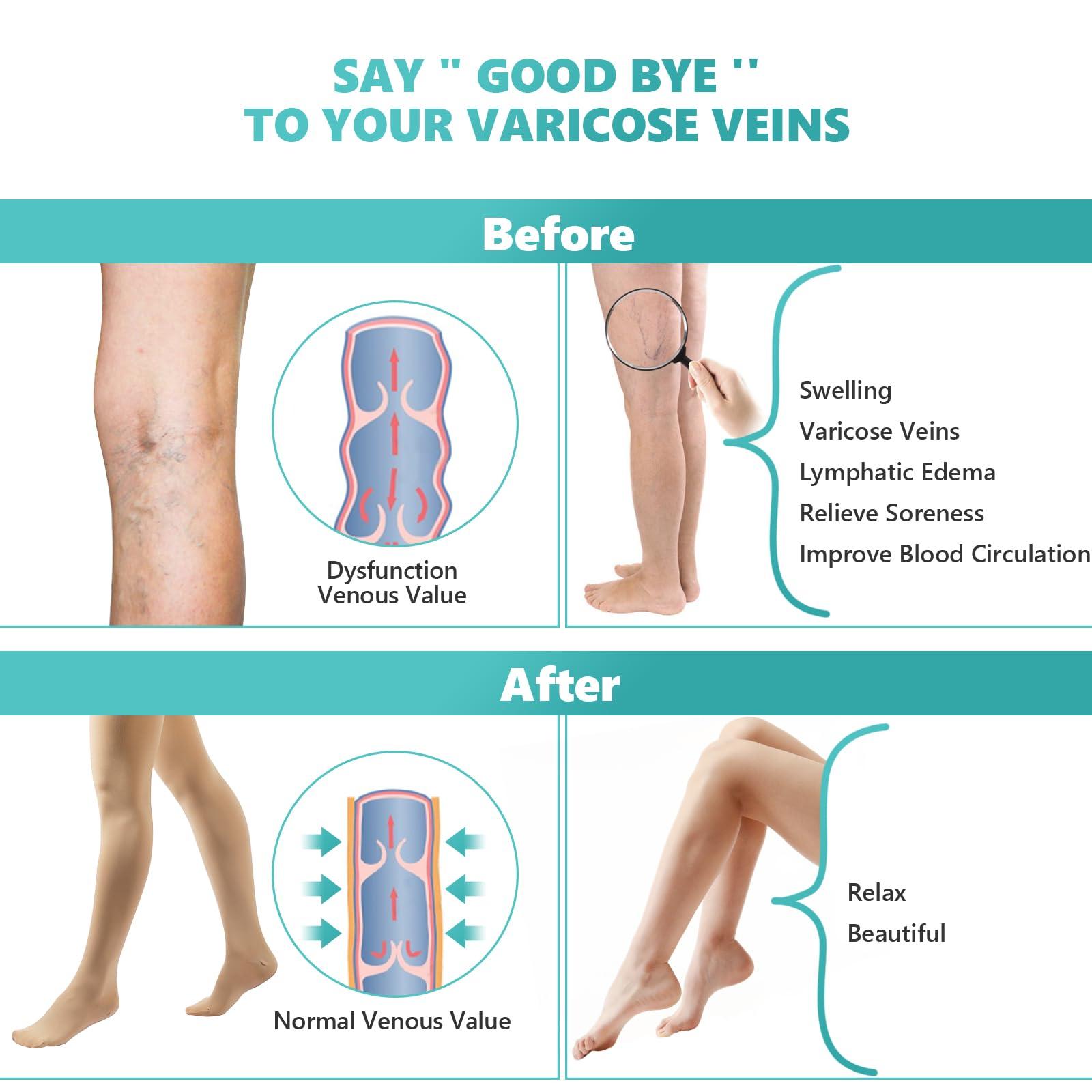 Laubawck Compression Pantyhose Stockings for Women Men, 20-30 mmHg Medical Graduated Support Opaque Closed Toe Hose Tights for Swelling, Edema Varicose Veins Waist High Compression Stockings