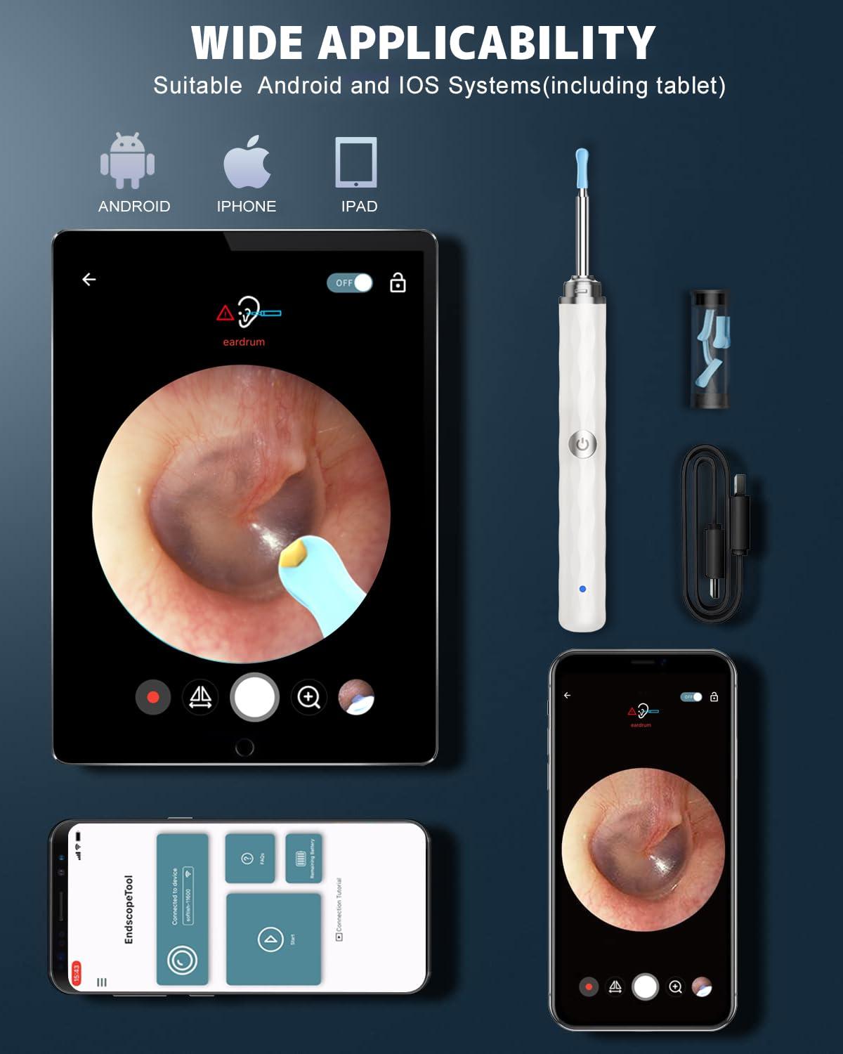 Right Ear Wax Removal, Ear Cleaner with Camera and Light, Ear Wax Removal Kit with 1296P Otoscope, Ear Cleaning Tool with 6 Ear Spoon, Ear Camera for iPhone & Android Phones,White