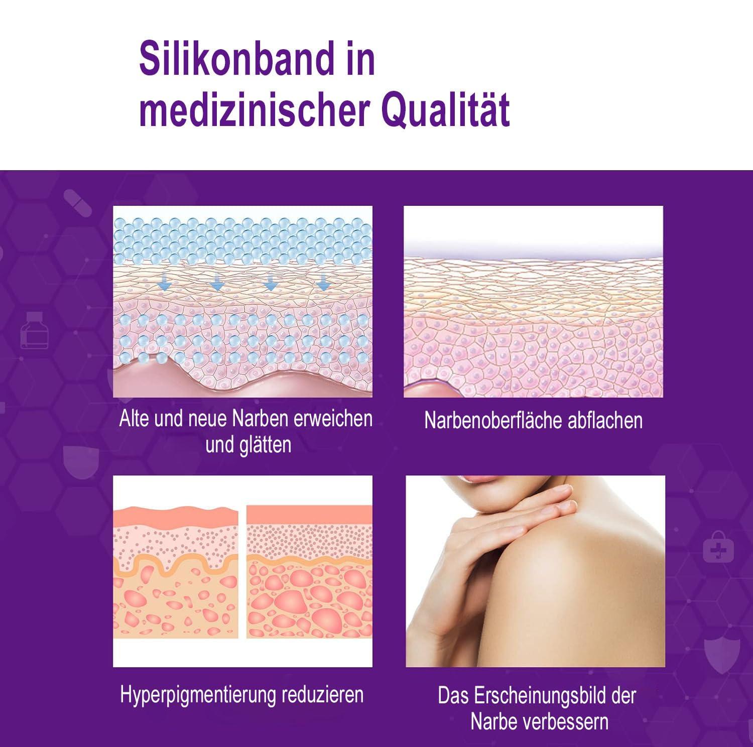 Kelinul Silicone Scar Sheets(1.6 x 120\"Roll-3M) Scar Removal Silicone Scar Tape for Softening and Flattening Scars, Acne, C-Section, Keloid Surgery, Painless Removal, Reusable, Washable, 10-12 Month Supply