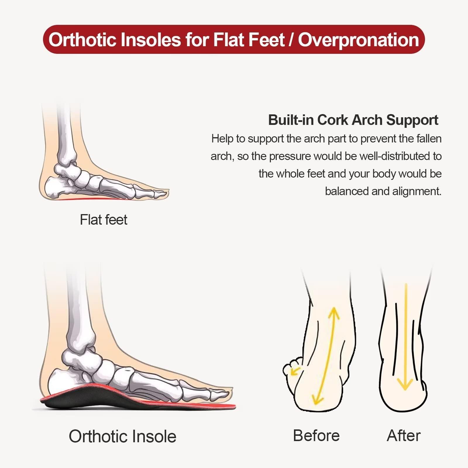 3ANGNI 3ANGNI Arch Support Insoles, Orthotic Insoles for Flantar Fasciitis Flat Feet Low Arch Pronation Metatarsalgia, High Arch Foot Support Orthopedic Insert Men Women (Men 12-12.5 / Women 14-14.5, Red)