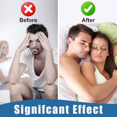 tyelason Tyelason Nasal Strips - 120 Count Nasal Strips for Snoring, Extra Strength Tan Nasal Breathing Strips to Improve Sleep, Instant Nasal Congestion Relief Caused by Colds & Allergies