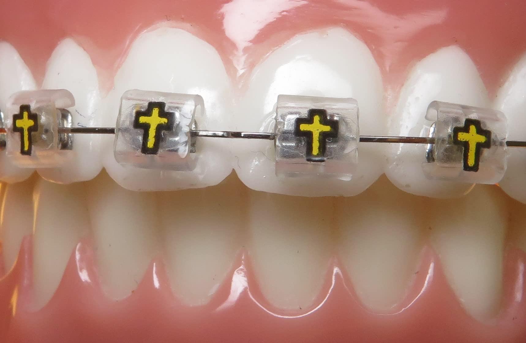 Snapcaps Snapcaps Braces Bumper Cover, Orthodontic Bracket Wax Substitute, Alternative Snap-on Braces Guard Braces Accessories 10 pack (Cross)