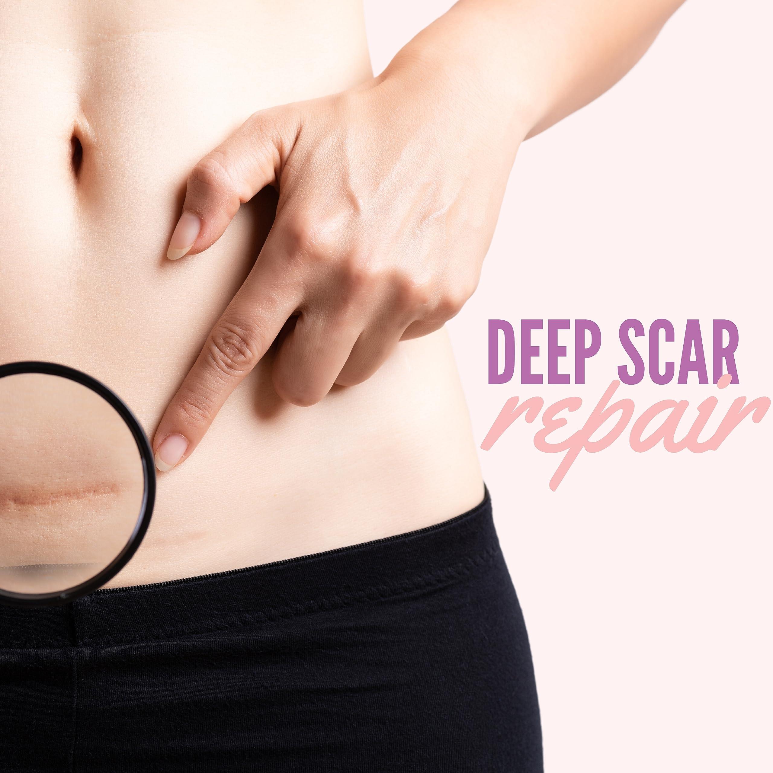 genovie MD Genovie MD Medical Grade Silicone Scar Sheets - Scar Tape Roll Treatment for C-Sections, Keloids, Acne, Post Operative Surgeries, Burns, 6 month Supply, Reusable and Removable Scar Sheets