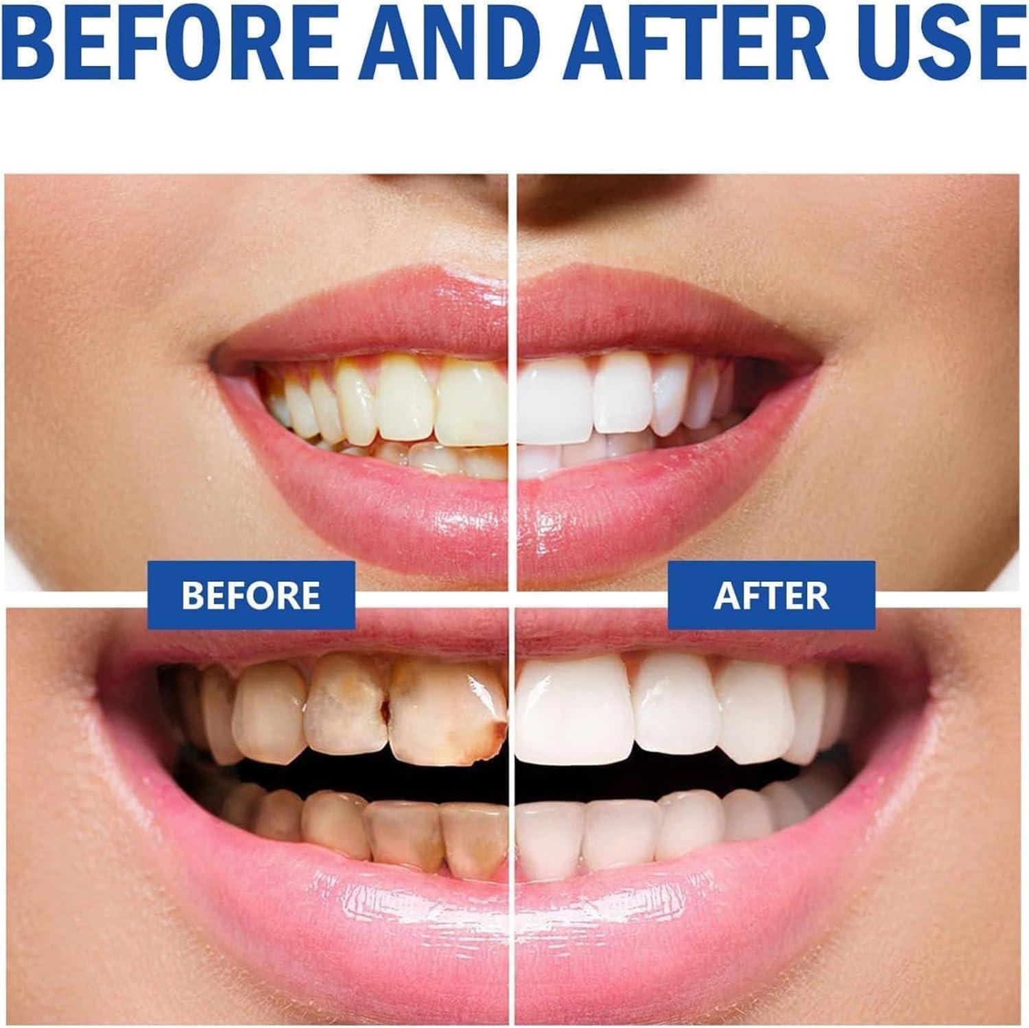 HEKEWER SP 10 Probiotic Toothpaste, SP-10 Brightening Super Probiotics Whitening Toothpaste, SP 10 Toothpaste, Fresh Breath, Super Probiotic-6, Deep Cleaning Care Toothpaste (3PCS)
