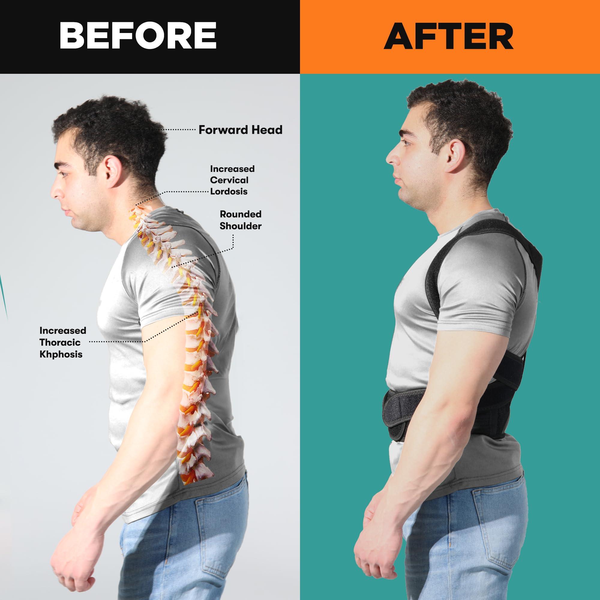 Titan Tough Titan Tough Posture Corrector for Men, Adjustable Mens Posture Corrector, Back Straightener, Correction, Support, Posture Brace for Women, Comfy Brace for Alignment (XXL)