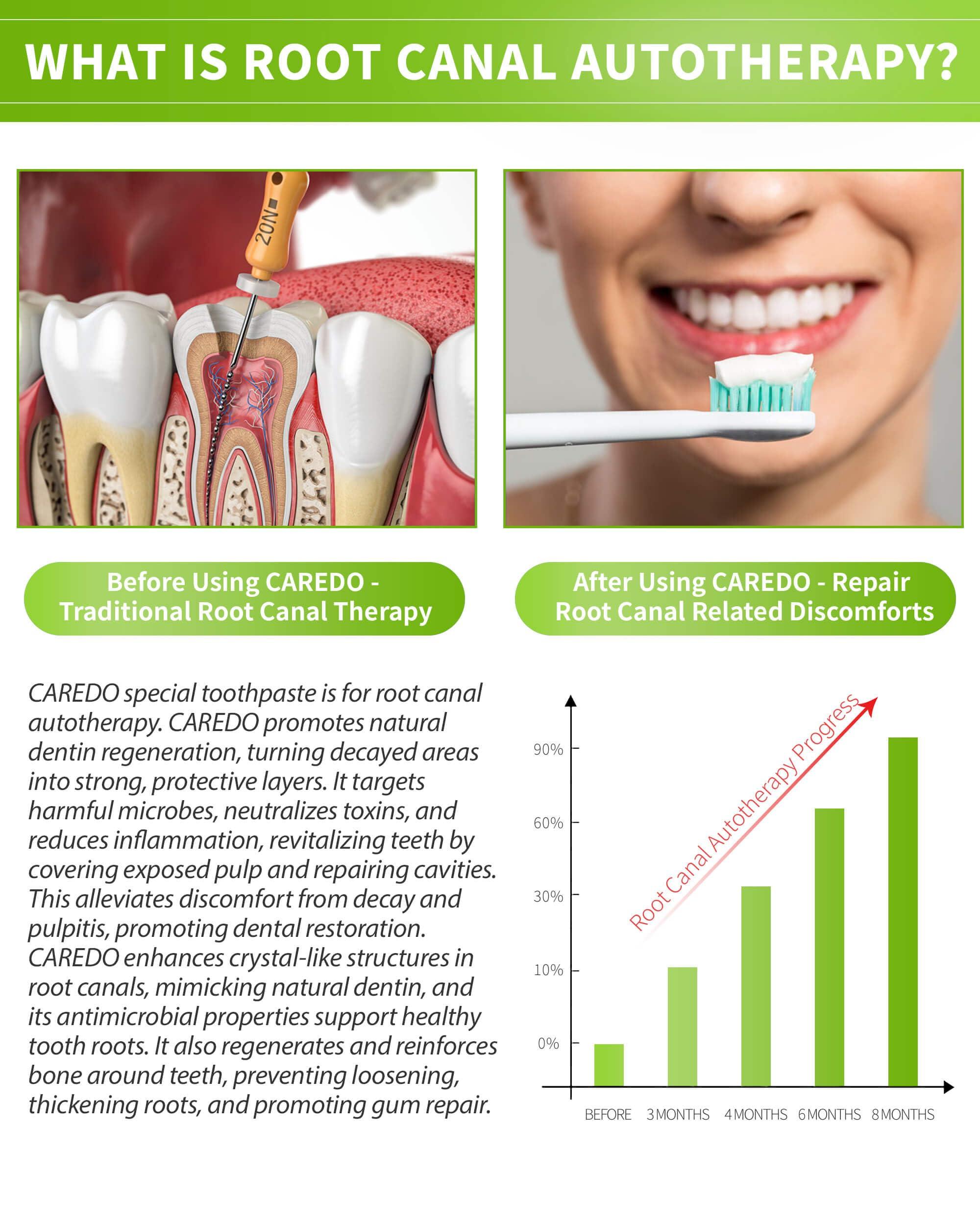 CAREDO CAREDO Gingivitis Toothpaste Avoid Root Canal Pulpitis for Adults, Gingivitis at Home, Gum for Receding Gums with Hydroxyapatite Toothpaste (100g+16g 2pcs)