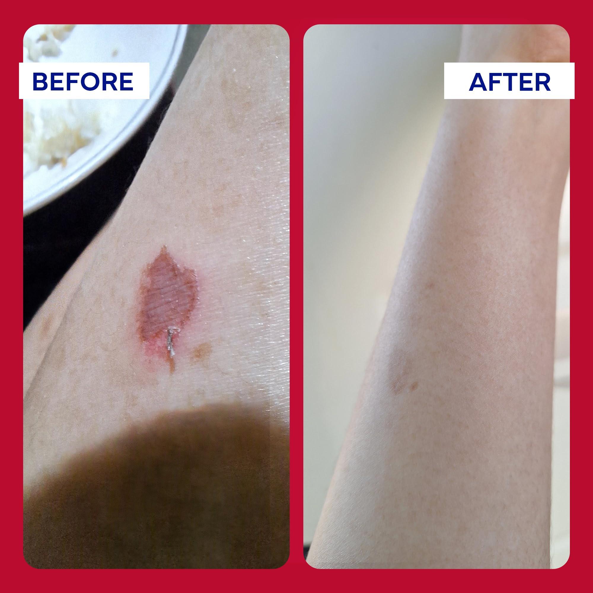 emuaid EMUAIDMAX First Aid Homeopathic Ointment, Natural Fast-Acting Topical Ointment for Resistant Skin Conditions, Reduces Itching, Pain, and Swelling, On-The-Go Travel Size, 0.35oz, 2 Pack