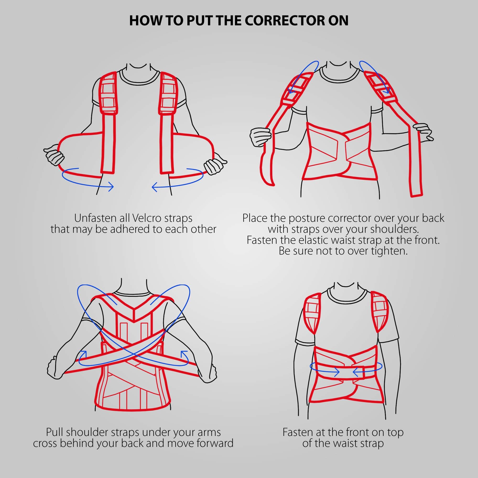 ORTONYX ORTONYX TLSO Full Back Support Brace with Removable Dorso-Lumbar Pad - Lightweight, Breathable - Pain Relief, Thoracic Kyphosis, Herniated Disc / ACHB5248-S