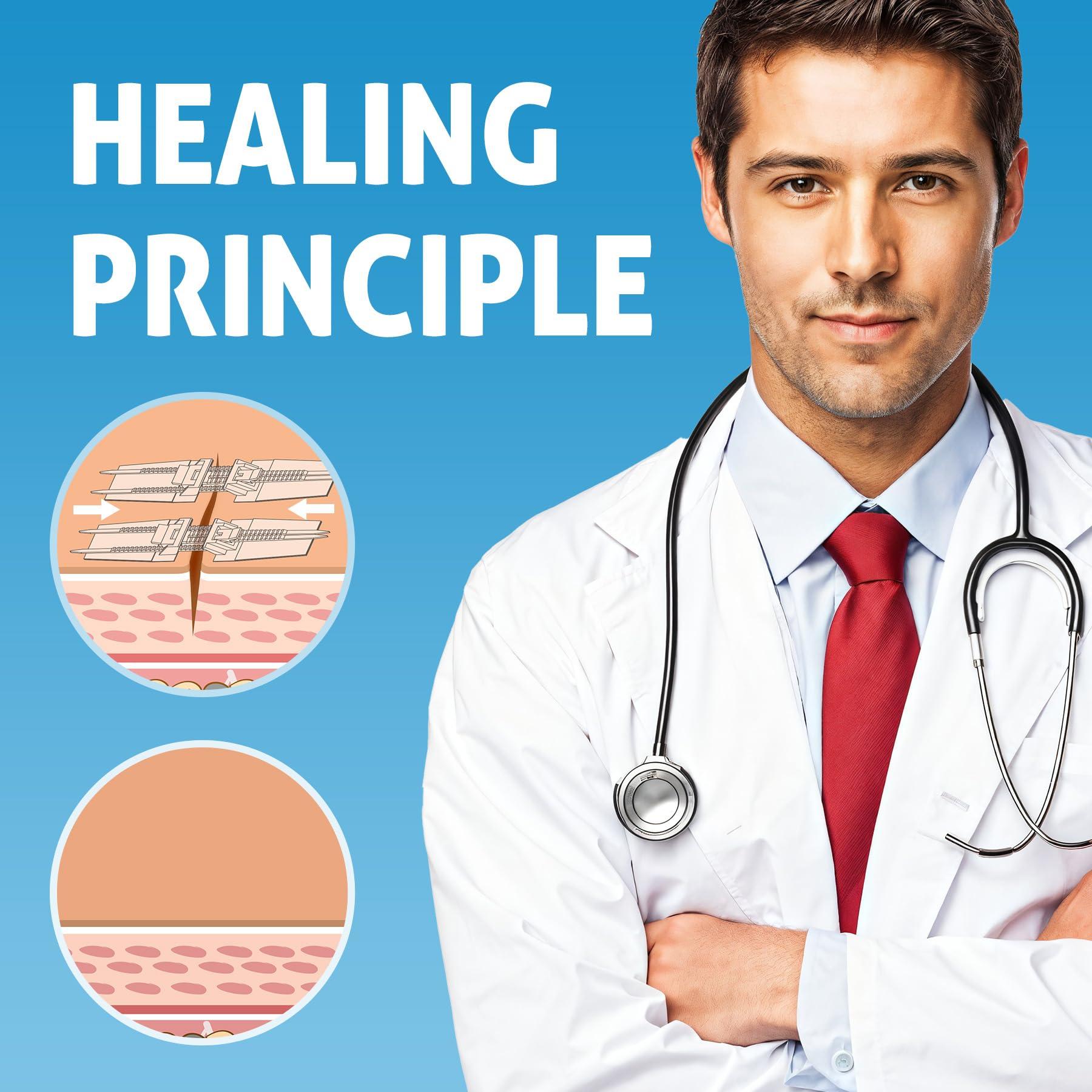 SEABIRD Zip Stitch Wound Closure Kit, Butterfly Bandages,Quick Clot for Easy Use, Surgical Quality,Emergency Laceration Closures Strips, Suture-Free Surgical Repairment, First Aid Wound Care (Yellow, 6)