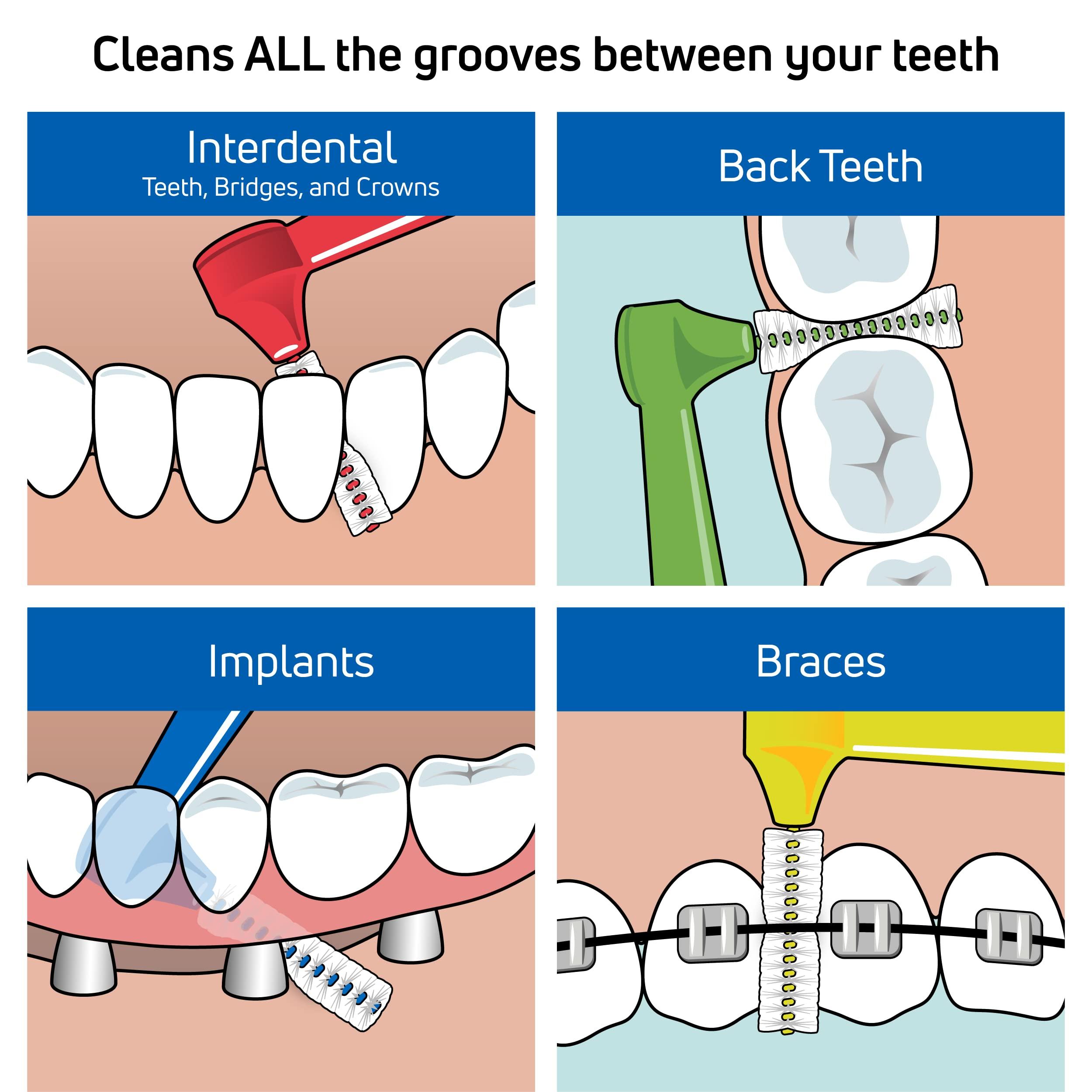 TEPE TEPE Interdental Brush Angle, Angled Dental Brush for Teeth Cleaning, Pack of 6, 0.40 mm, Extra-Small/Small Gaps, Pink, Size 0