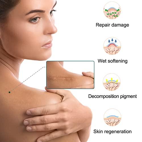 Moulis Silicone Scar Sheets (1.6” x 120” Roll-3M), Silicone Scar Tape Roll, Scar Silicone Strips, Reusable, Professional Scar Removal Sheets for C-Section, Surgery, Burn, Keloid, Acne et