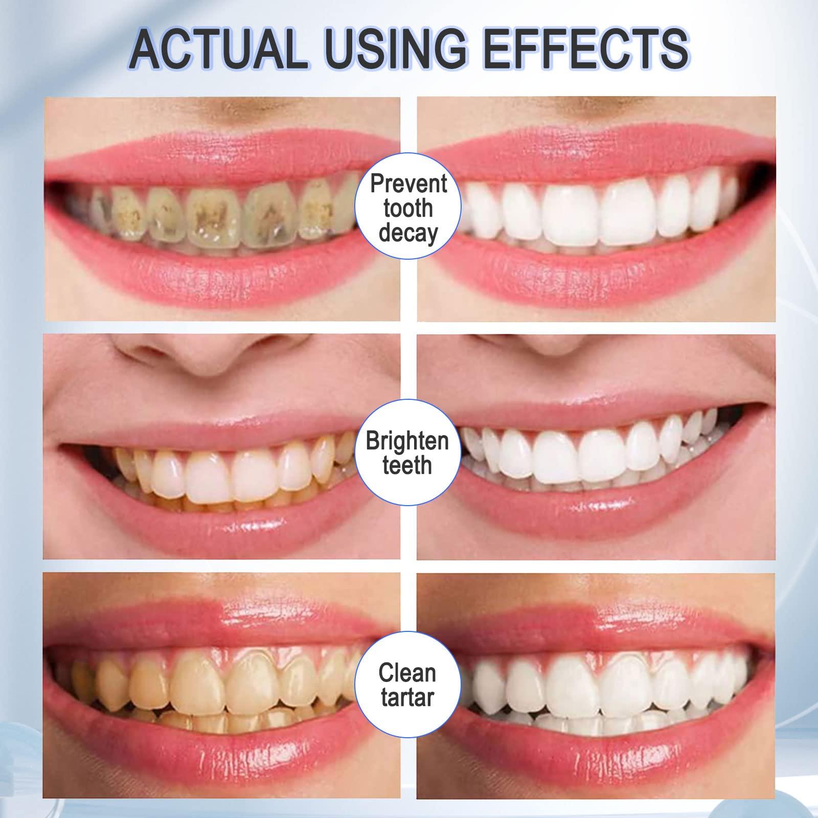 VOGSIG Teeth Whitening Toothpaste with Fluoride, Foam Toothpaste, Ultra-fine Mousse Foam Deeply Cleaning Gums, Stain Removal, Oral Care-Toothpaste Replacement Natural Mouth Wash Water, 3 Fresh Flavor