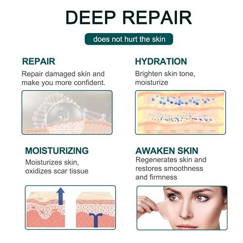 Moulis Silicone Scar Sheets (1.6” x 120” Roll-3M), Silicone Scar Tape Roll, Scar Silicone Strips, Reusable, Professional Scar Removal Sheets for C-Section, Surgery, Burn, Keloid, Acne et