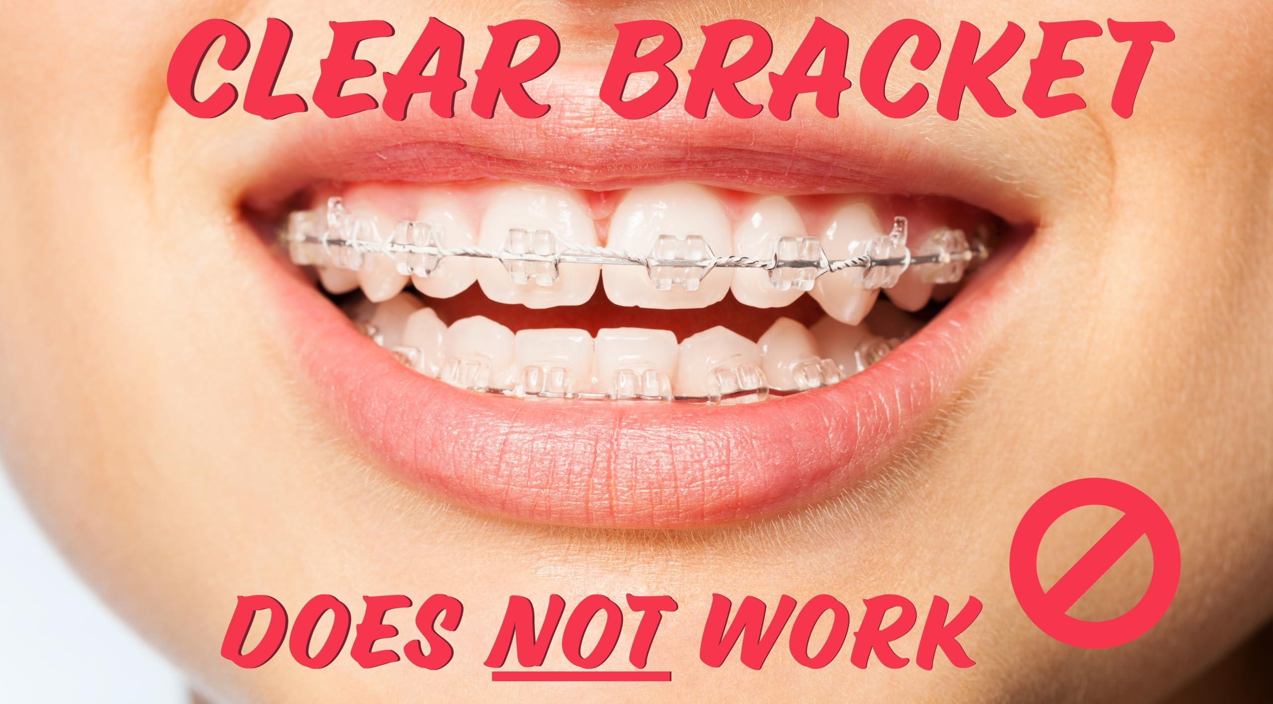 Snapcaps Snapcaps Braces Bumper Cover, Orthodontic Bracket Wax Substitute, Alternative Snap-on Braces Guard Braces Accessories 10 pack (Bow)