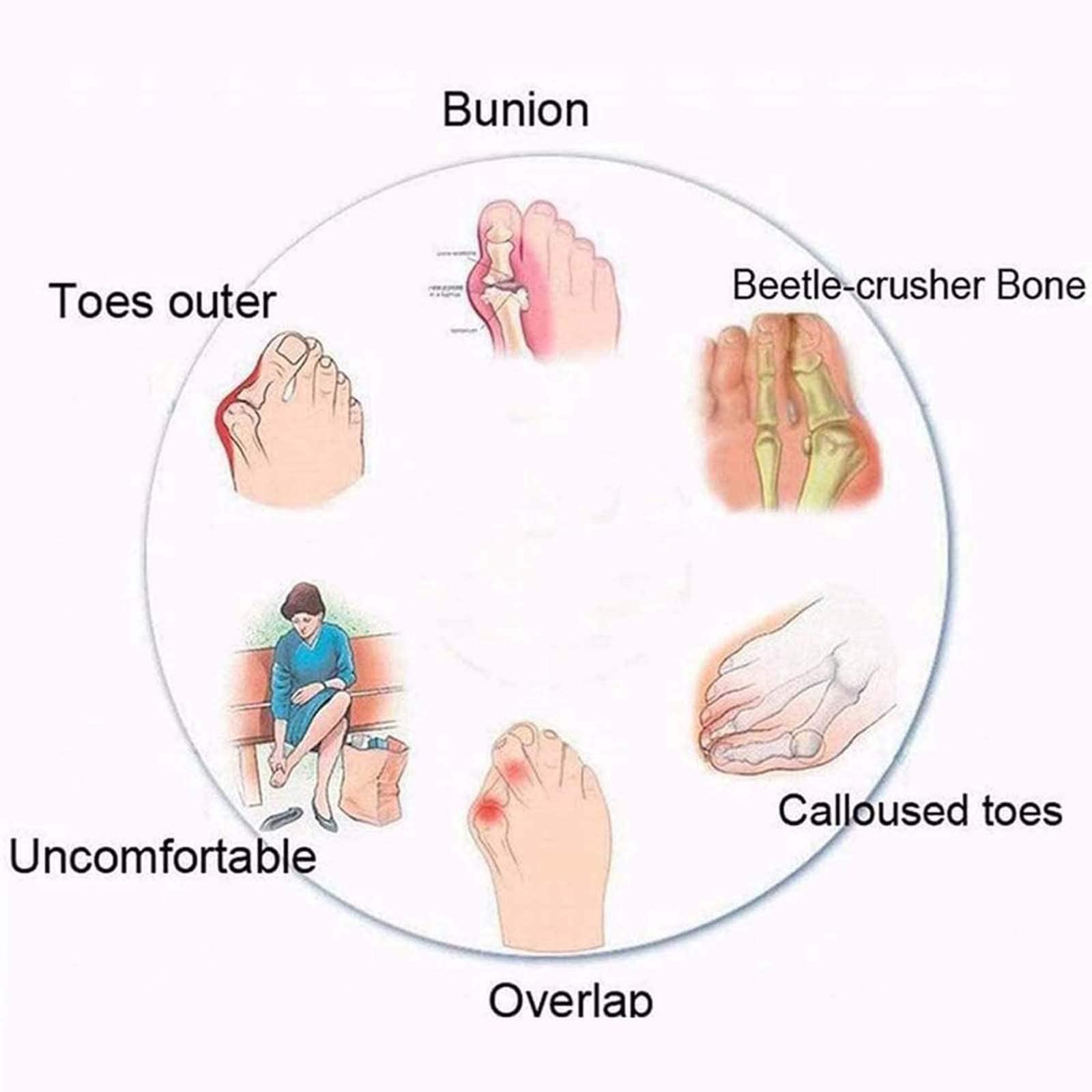 Generic Orthotic Flip Flops for Women, Plantar Fasciitis Sandals for Flat Feet with Arch Support Thong Style Flip Flops Sandals for Comfortable Walk,Black,39