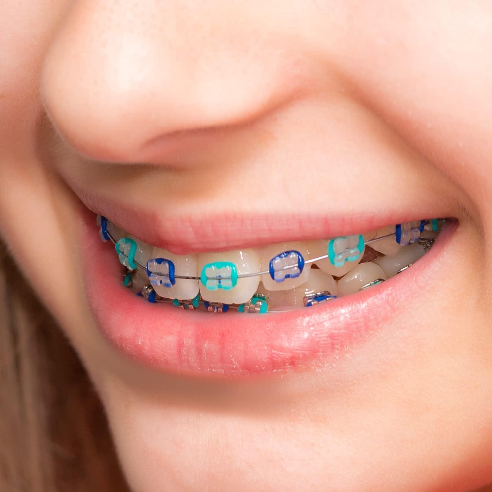 PROTECTOR Dental Orthodontic Ligature Ties Braces 1040 Pcs, Ortho Braces Color Bands Ligature Ties Elastomeric O-Rings for Braces (Multi color)
