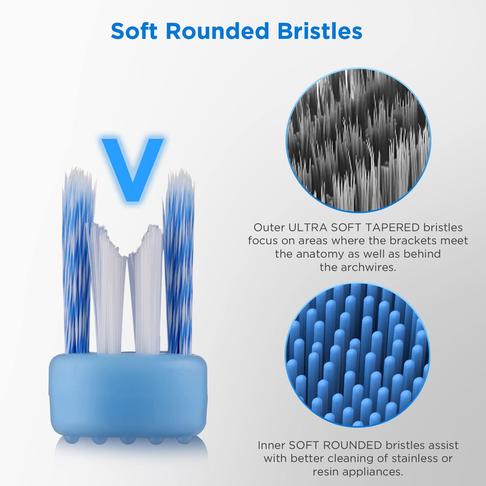 Fremouth Fremouth V-Shaped Orthodontic Toothbrush for Braces, Soft Bristles, 6 Count