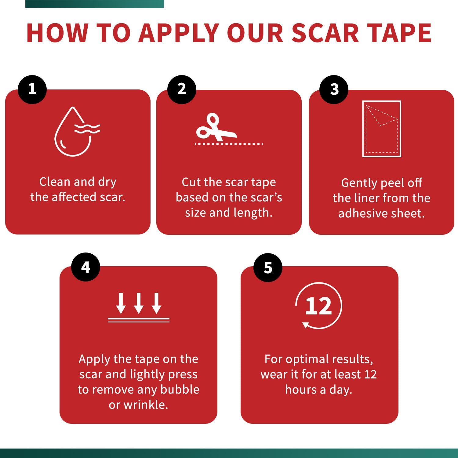Protect Life Medical Grade Silicone Scar Tape Advanced Adhesive Formulation (1.6" x 118") Scar Removal Away Strips for Surgical Scars, Silicone Tape & Keloid Scar Treatment, Reusable Silicone Scar Sheets