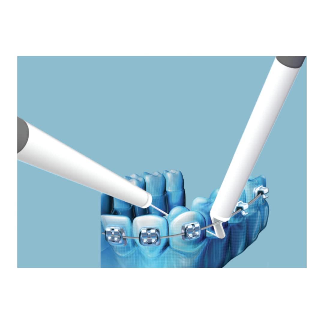 Gumchucks GumChucks Orthodontic Flossers Dental Floss - Floss for Braces - Brace Floss Picks - Gum Flossing Picks - Ortho Dental Flossers (Adult Starter Pack)