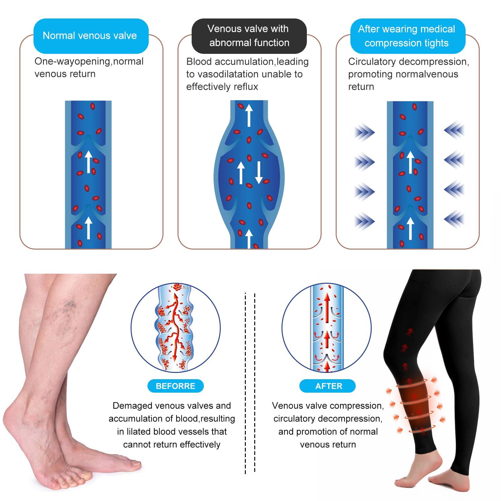 YISEMEYA Medical Compression Pantyhose for Women & Men, 20-30mmHg Graduated Support Tights, Opaque Footless High Waist (Black, L)