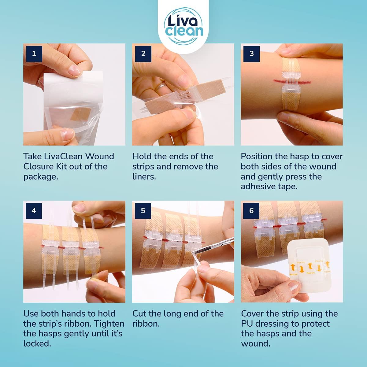 LivaClean (6 CT) 1 X 3.7 Wound Closure Strips - Zip Stitch Wound Closure Kit - Butterfly Kit Device Zip Tie Skin Closuing Butterfly Bandaids Adhesive Injury-Closing Glue Steri Strips Bandages Sutures