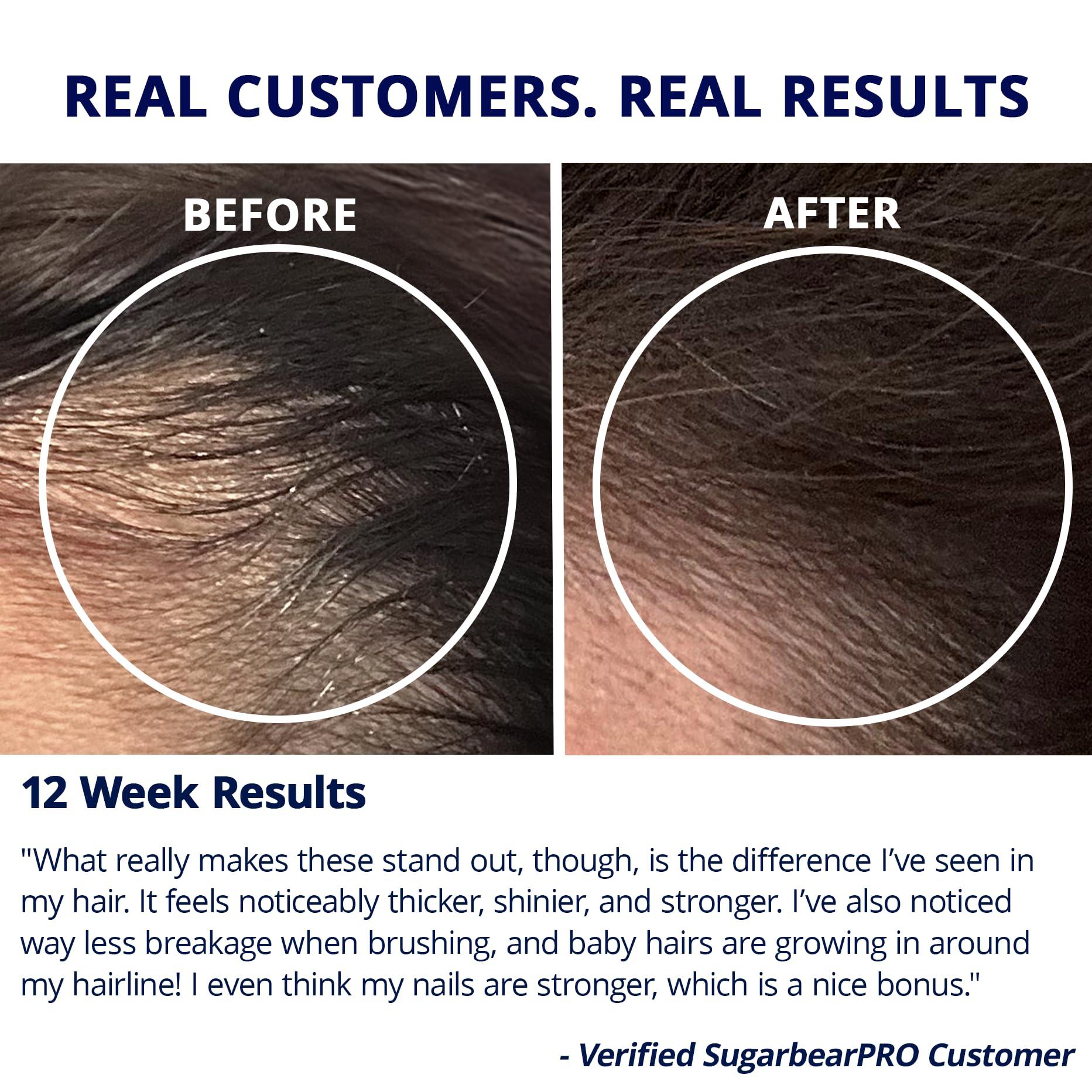 SugarBearHair Sugarbear Hair Vitamin Gummy 2 Month Supply Extra Strength Biotin 6000mcg, Growth for Men & Women, Vegan Vitamin B12, MSM, Inositol, Omega 3, Elderberry, Certified Kosher, Halal, Cruelty-Free