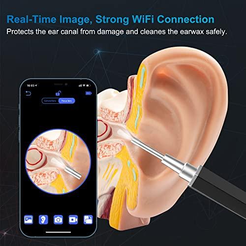 VANBAR Ear Wax Removal, Ear Cleaner with Camera Earwax Remover Tool, Ear Camera Otoscope kit with Light, Ear Wax Camera with 6 Ear Spoon for Kids, Adults & Pets
