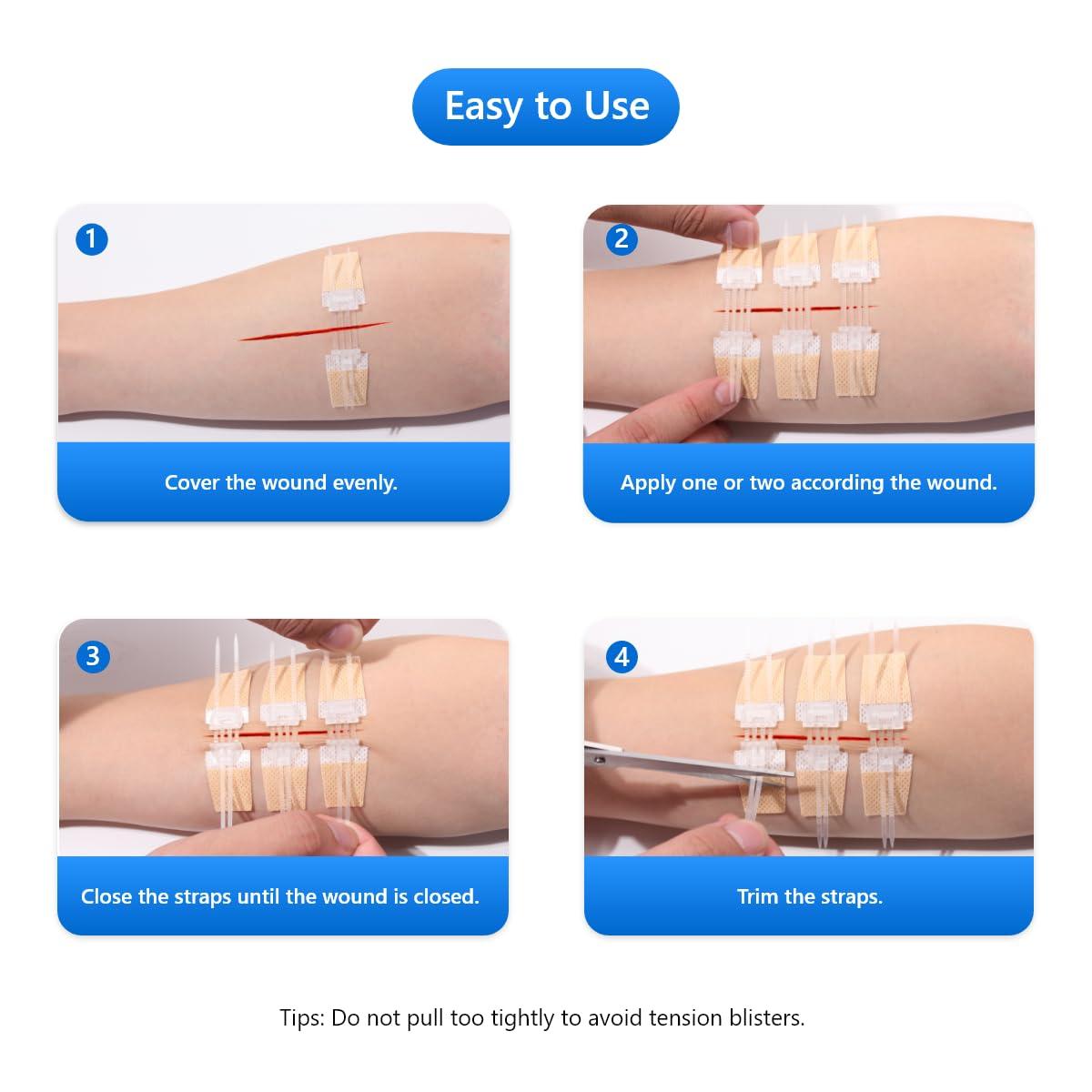 Longmed Longmed Emergency Wound Closures - 10 Pcs Zipper Wound Closure Device Painless Stitch Sutures Laceration Repair Without Stitches Adhesive Bandages for First Aid Wound Care(Factory Direct Sale)