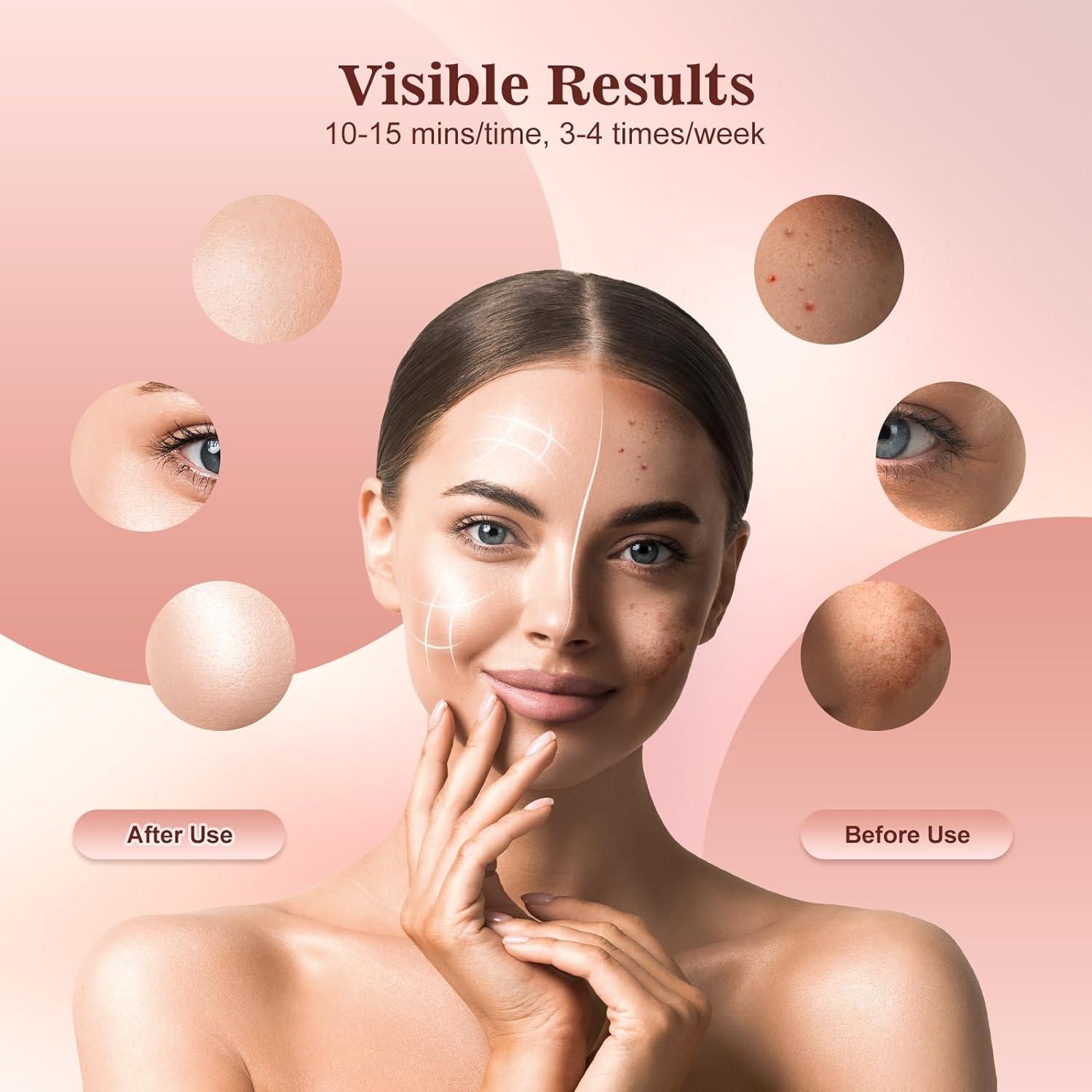 INTEO Red Light Therapy for Face, 3 Modes Portable Led Face Mask Light Therapy with Remote, Near-infrared 850 Red Light Therapy Mask with Timing Function, Red Light Therapy At Home 180 LED Beads