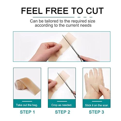 Moulis Silicone Scar Sheets (1.6” x 120” Roll-3M), Silicone Scar Tape Roll, Scar Silicone Strips, Reusable, Professional Scar Removal Sheets for C-Section, Surgery, Burn, Keloid, Acne et