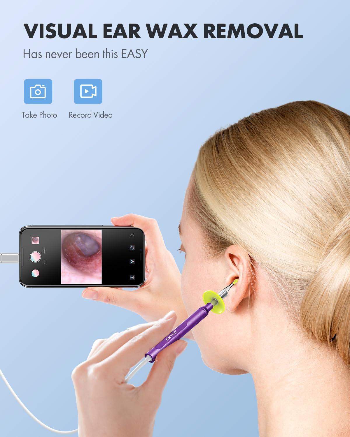 Anykit Anykit Digital Otoscope for Phone & Tablet, Ultra Clear View Ear Camera with Ear Wax Removal Tools, Video Ear Scope Otoscope with Light, Support Capture Photo & Record Videos