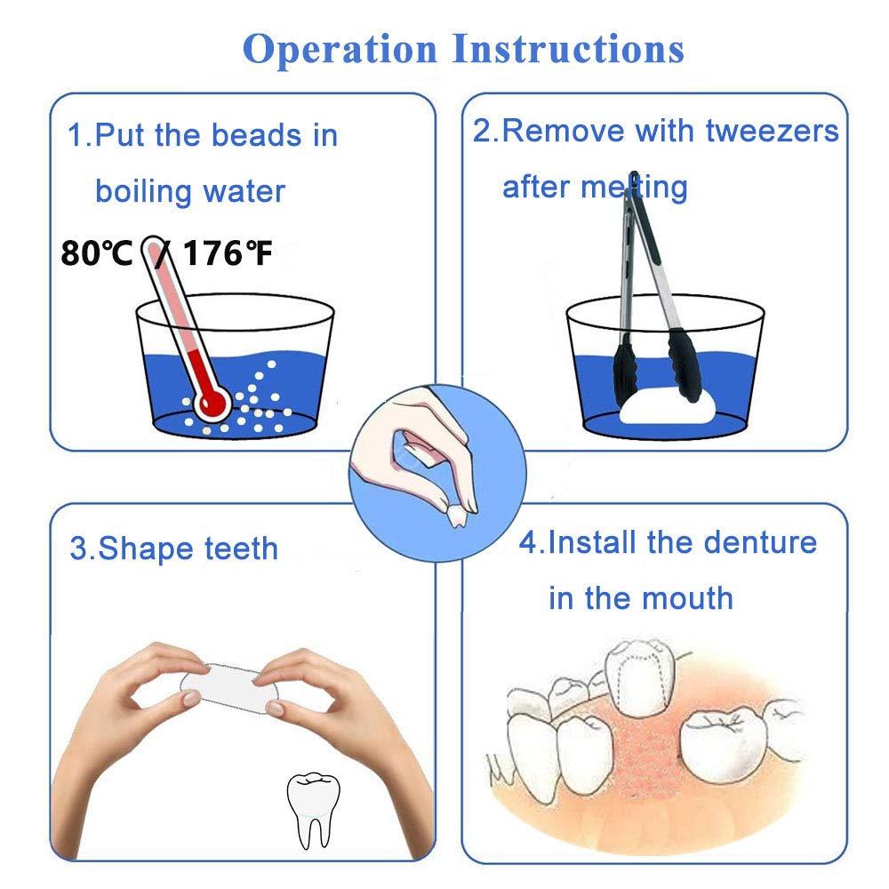Brige Brige Tooth Repair kit for Filling The Missing Broken Tooth and Gaps-Moldable Fake Teeth and Thermal Beads Replacement Kit