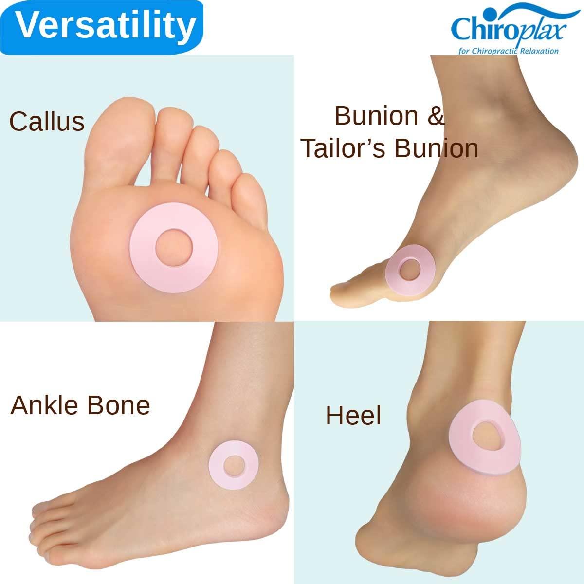 Chiroplax Chiroplax Foam Callus Cushions Pads Protectors Waterproof Self-Adhesive Blister Toe Foot Pain Relief Treatment (72 Count)