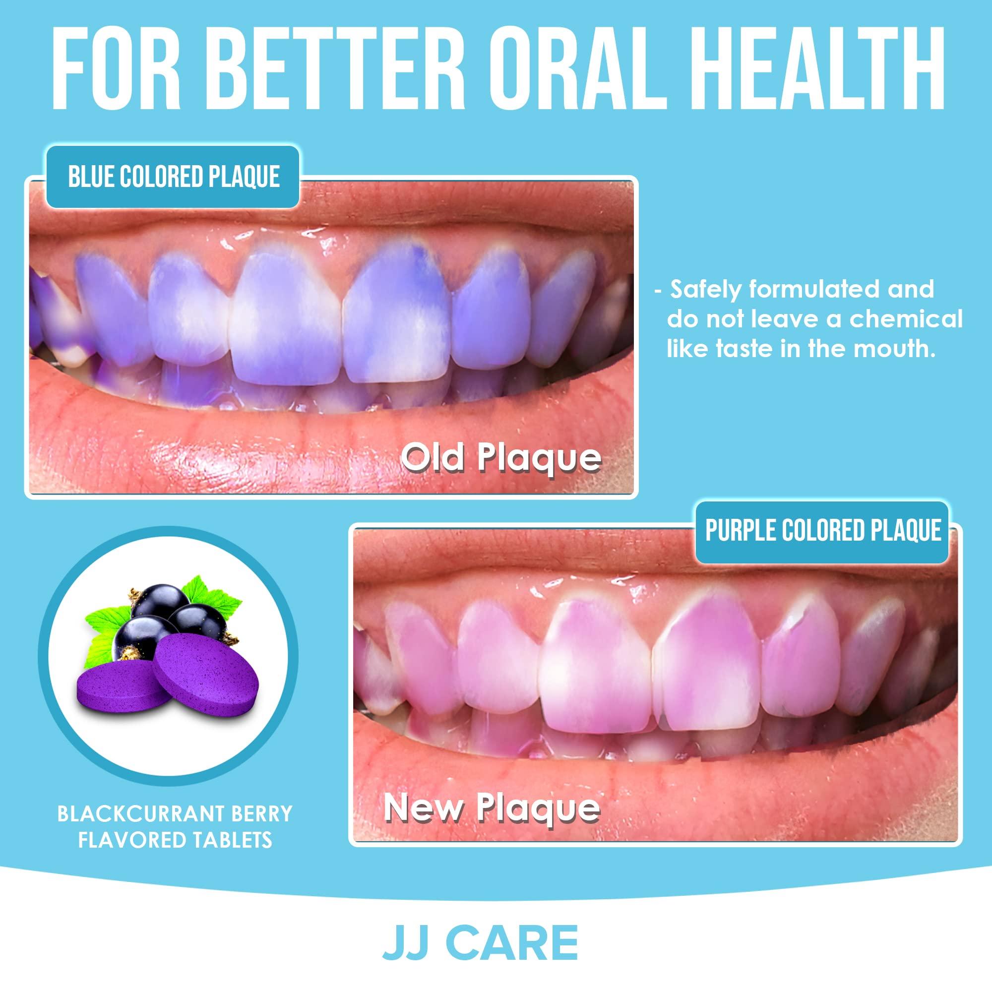 JJ CARE JJ Care Disclosing Tablets for Kids - 120 Count Plaque Disclosing Tablets, Berry Flavored Dental Plaque Tablets for Kids and Adults, Individually Wrapped Plaque Disclosing Tablets