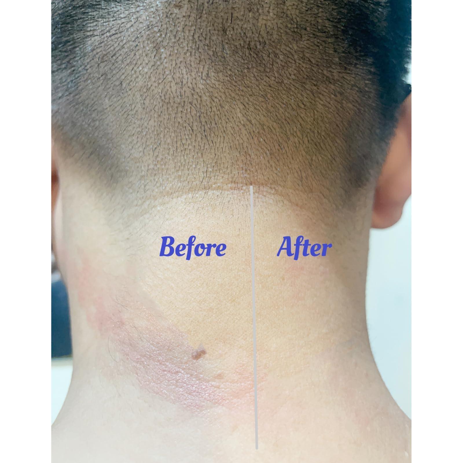 playWooWgo 4 Packs CPAP Strap Covers +1 Pack Neck Comfort Pad CPAP Mask Cover Compatible with Full CPAP Mask to Reduce Headgear Pressure and Cheek Red Marks Extend CPAP Strap Useful Life for CPAP Supplies