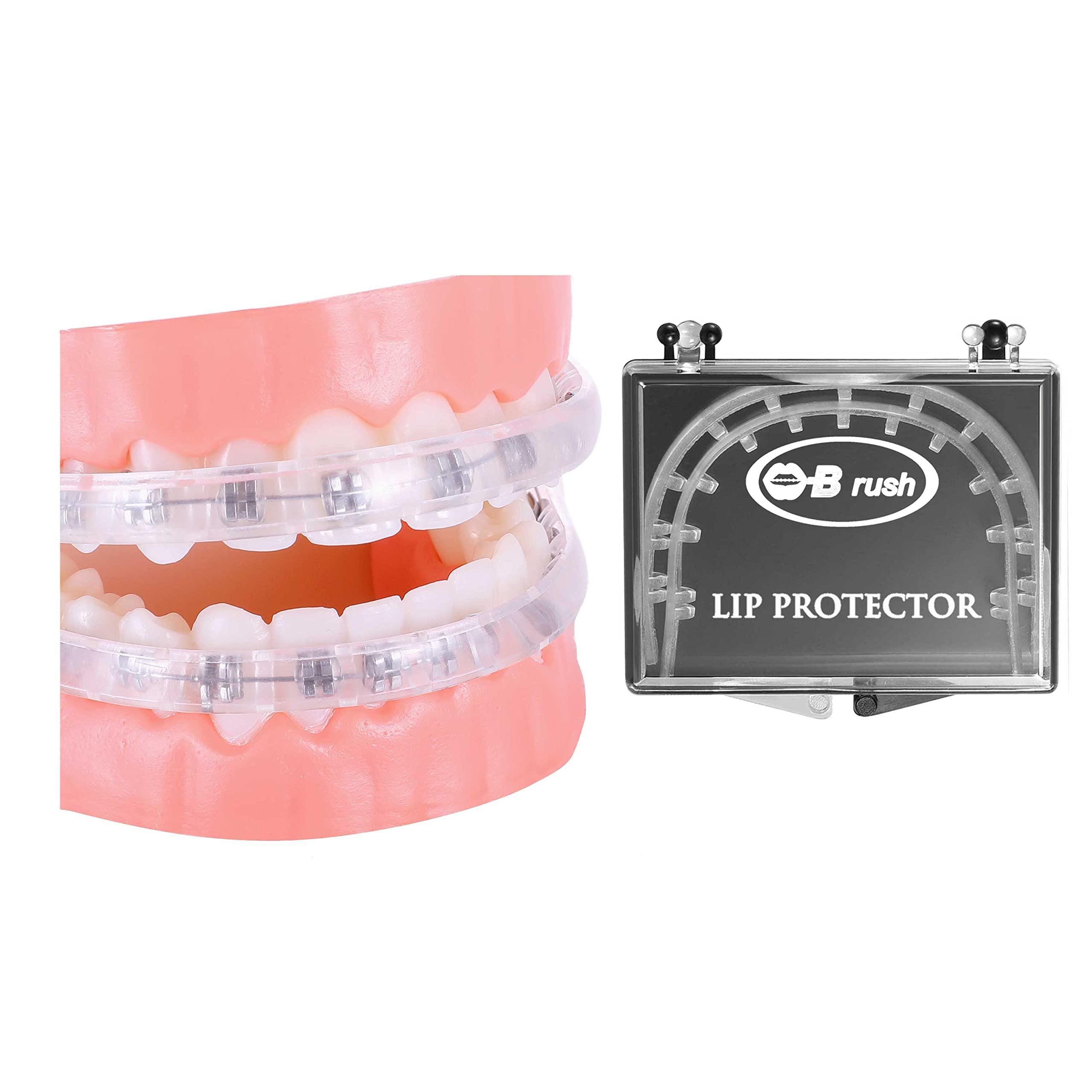 OBrush Obrush Comfort Covers for Braces - Orthodontic Mouth Guard, Lip Protector, Wax Alternative, Lip Shield for Brackets