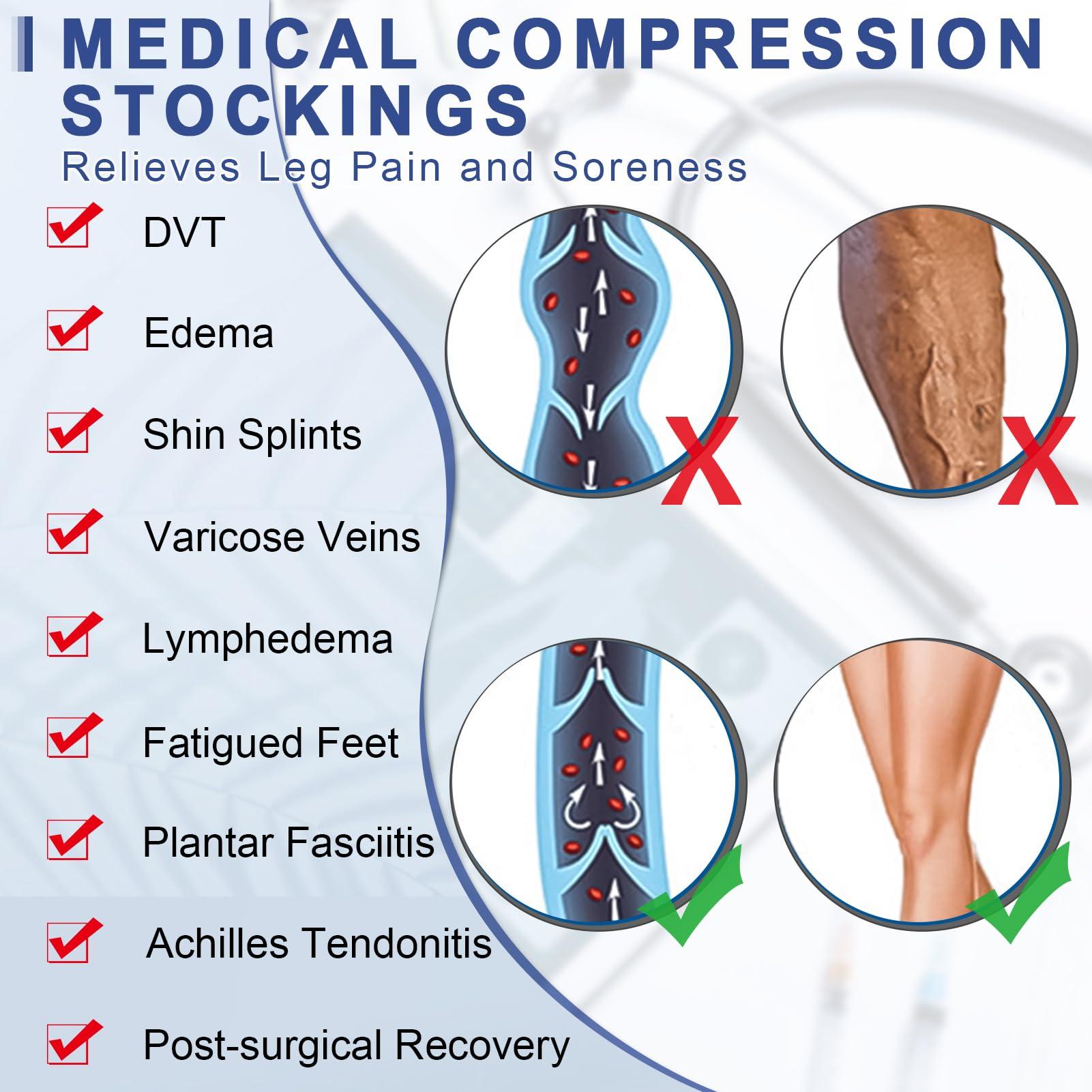 beister Beister 1 Pair Medical Open Toe Thigh High Compression Stockings with Silicone Band for Women & Men, Firm 20-30 mmHg Graduated Support for Varicose Veins, Edema, Flight.