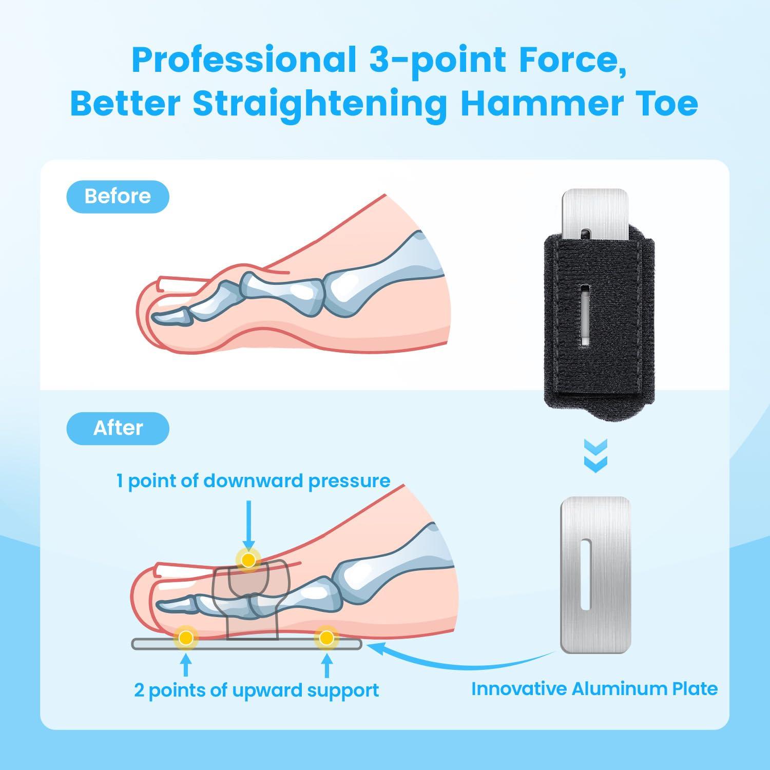 Pozpo Tech Hammer Toe Straightener Corrector Wrap for Women & Men, Hammer Toe Splint Support - 1 in package