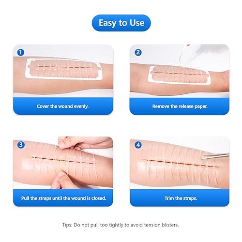 Longmed Longmed Emergency Wound Closures 7.76x2.36 Inch Adhesive Bandages Zip Sutures Butterfly Bandages for C-Section,Keloid, Post Surgery