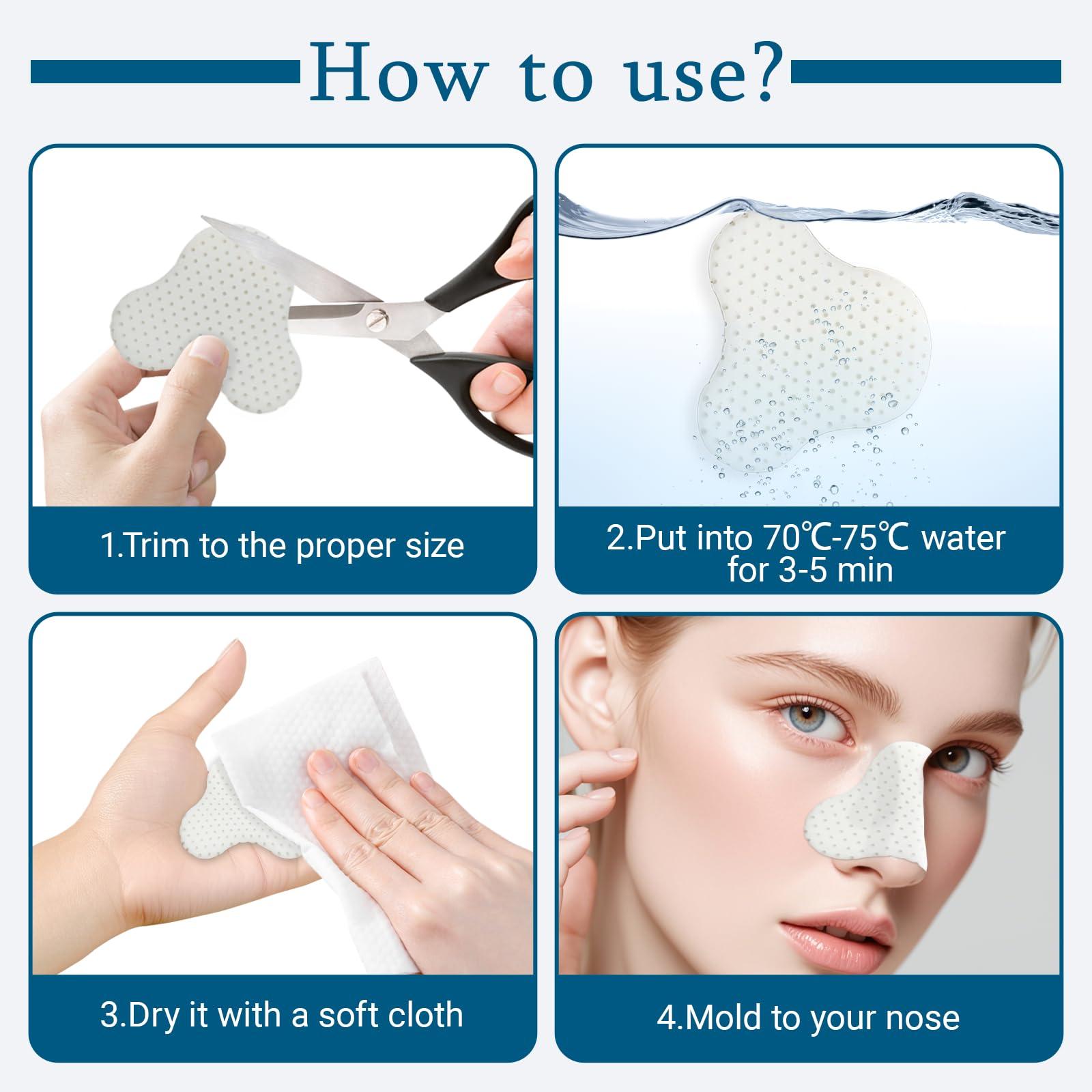 Mediss Thermoplastic Nasal Splints, External Nose Support Protector for Rhinoplasty Septoplasty Surgery, Nose Brace Fracture, ENT, Orthopedic Immobilization, 5pcs-L (C)