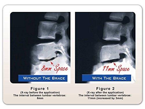 Disc Disease Solutions DDS 300 Decompression Lumbar Back Support Belt for Sciatica, Pneumatic Air Lumbar Traction for Back Pain Relief, Herniated Disc, Lower Back Brace for Women and Men, for Work, Lifting, Driving - Large