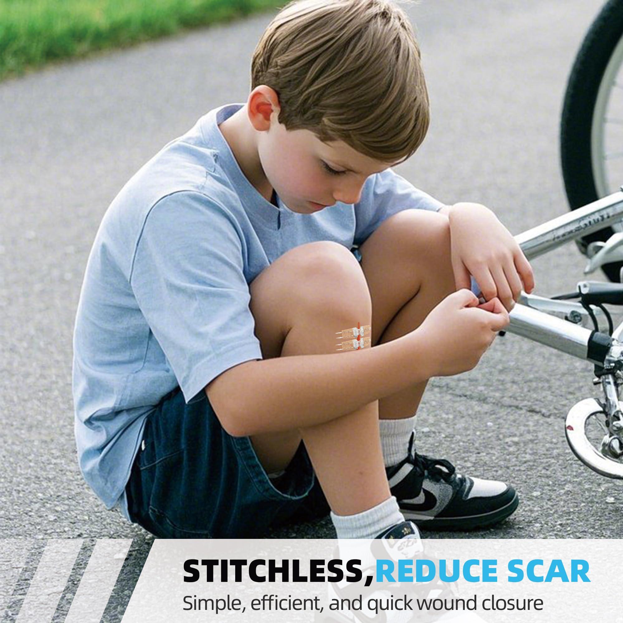 Longmed Longmed Emergency Wound Closures - 10 Pcs Zipper Wound Closure Device Painless Stitch Sutures Laceration Repair Without Stitches Adhesive Bandages for First Aid Wound Care(Factory Direct Sale)