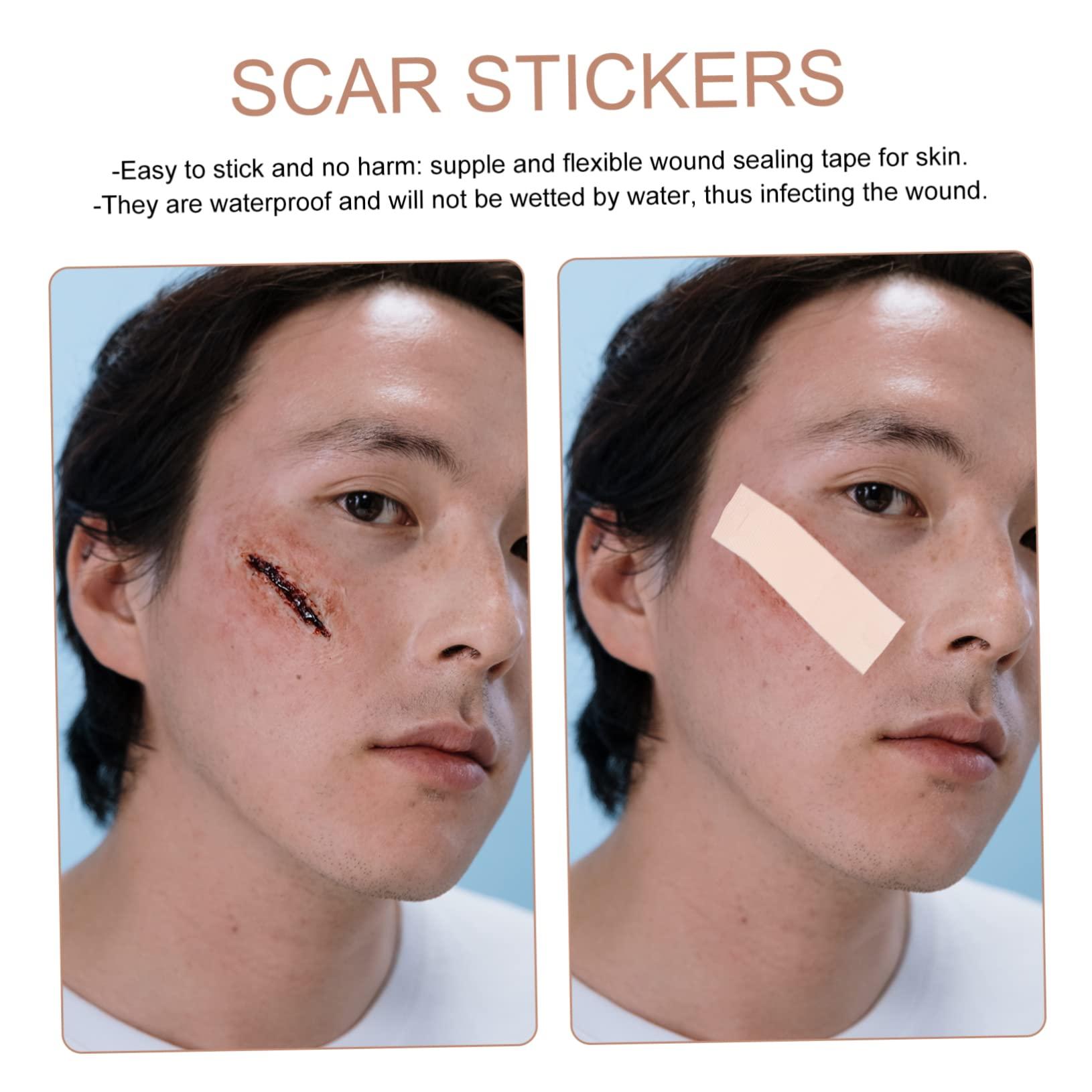 Hemoton Hemoton 5 Rolls Fade Scar Stickers Medical Patch Scar Dressings Waterproof Patches Scar Softening Stickers Cesarean Section Scar Bandages Lighten Scar Stickers Tape Baby Auricle