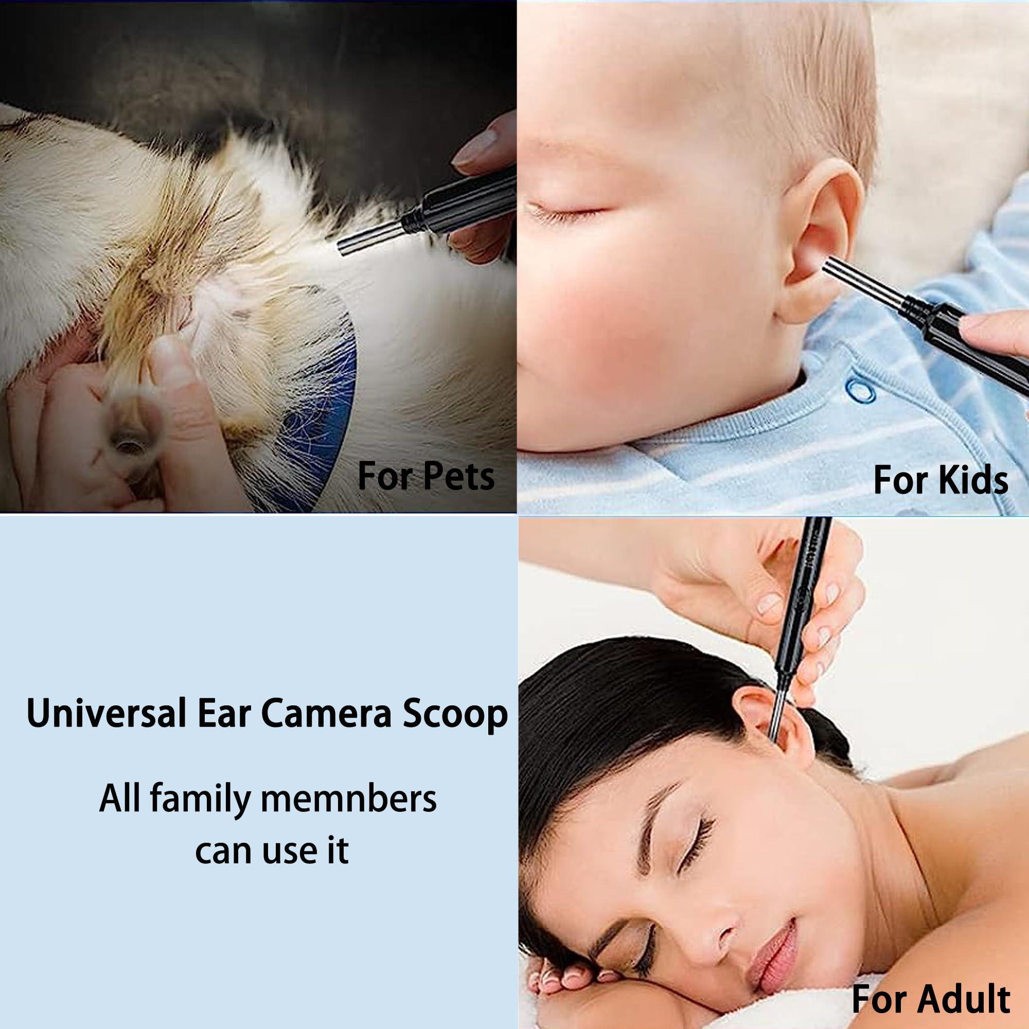 WILLFAN Ear Wax Removal with Camera, Ear Inspection System Wireless Earwax Removal Tool with Camera for Smart Devices
